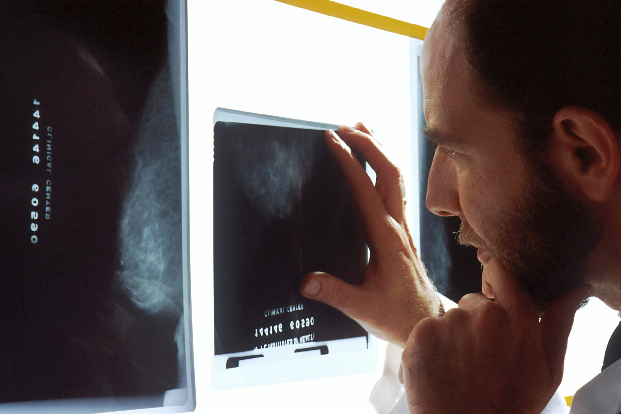 Early Signs of Prostate Problems